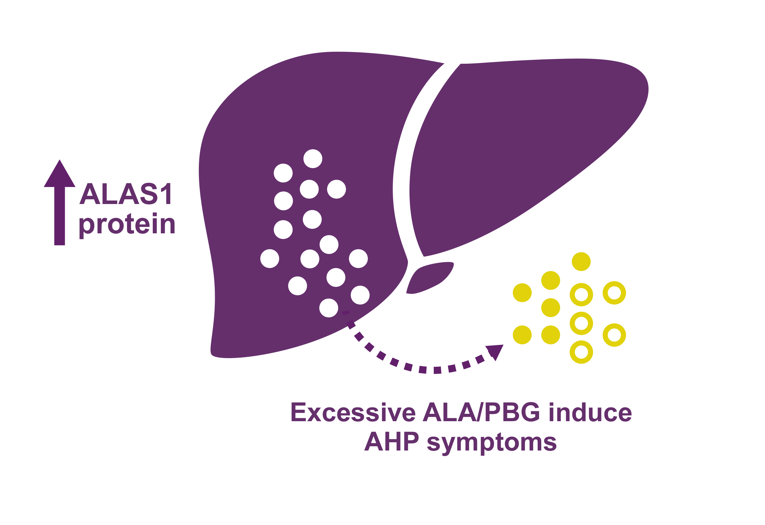 Upregulation of ALAS1 leads to neurotoxic accumulation of ALA and PBG